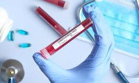 thêm 2 người tử vong và 12 ca nhiễm covid-19 tại mỹ hình 2