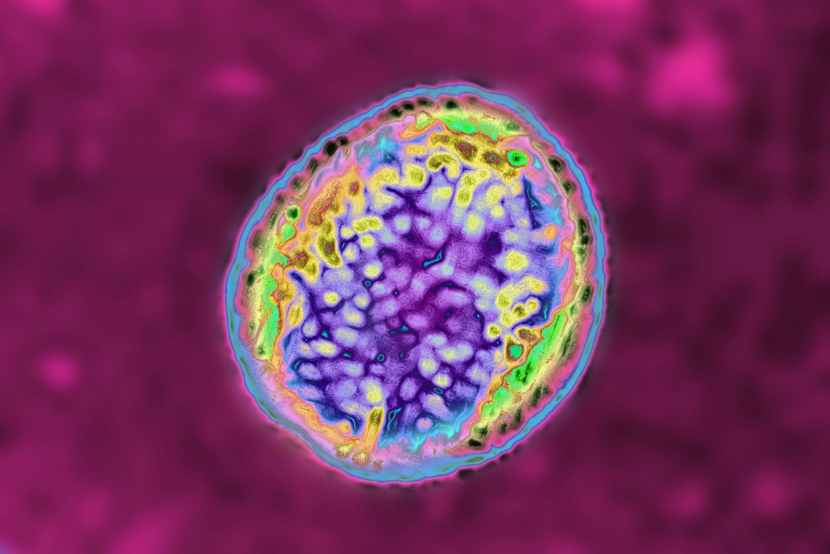 Brucellosis còn được gọi là sốt Malta hoặc sốt Địa Trung Hải.