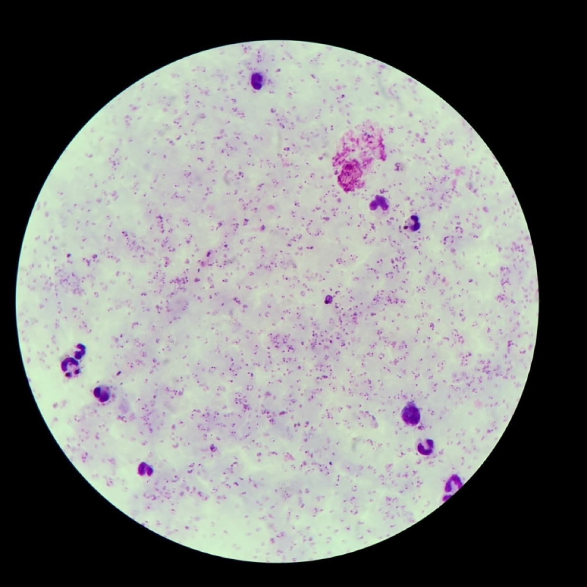 nguy co lay lan benh sot ret tai tp.hcm la rat thap hinh anh 1