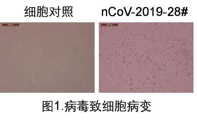 trung quoc phan lap duoc covid-19 trong nuoc tieu nguoi benh hinh 1