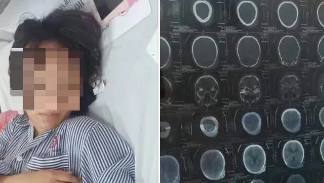 thong tin tiep vu nu sinh thpt bi danh hoi dong ngay giua tp ha long hinh 4