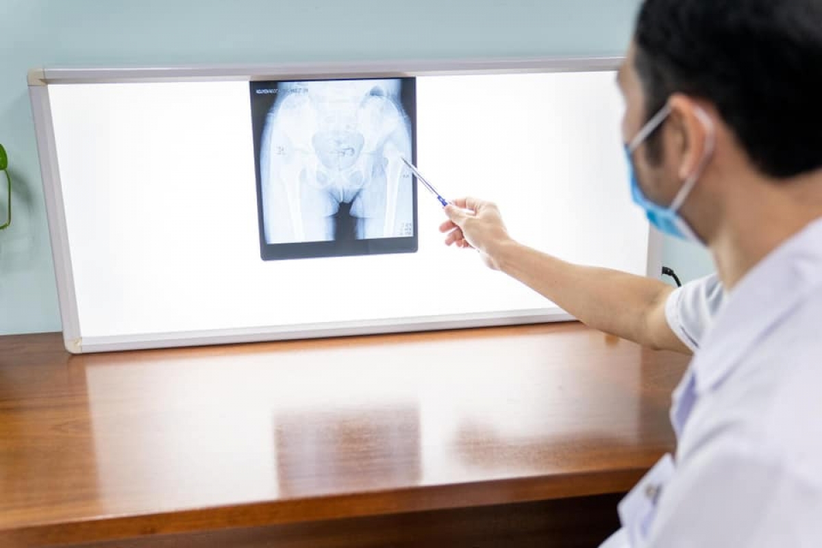 Phim chụp tổn thương khi trẻ bị trật khớp háng bẩm sinh