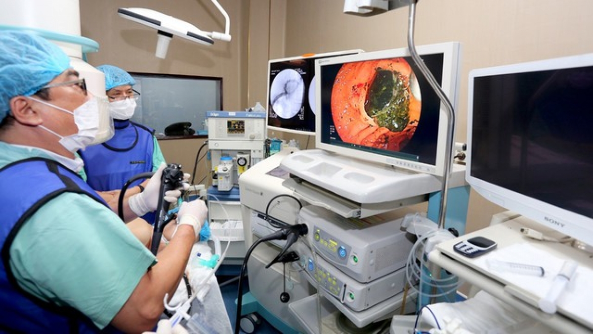 Các bác sĩ thực hiện tán sỏi trong gan cho bệnh nhân 