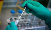 kit test nhanh khác kit pcr thế nào? hình 2