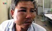 khởi tố chủ quán cà phê đánh nhân viên cây xanh nhập viện hình 2