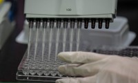 hành trình tìm vaccine ngừa covid-19: "lạc quan nhưng cần thực tế" hình 2