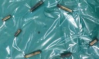 nuốt tăm xỉa răng, cụ ông bị đâm thủng ruột hình 2