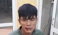 đứng nghe điện thoại bên đường, cô gái 19 tuổi bị cướp mất điện thoại hình 2
