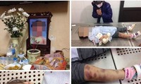 công an làm việc với bố cháu bé 2 tháng tuổi nghi bị bạo hành hình 2