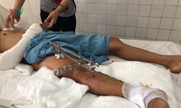 bệnh viện đà nẵng lần thứ 2 cứu sống bệnh nhân bằng cách hạ thân nhiệt hình 2