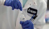 xét nghiệm kháng thể là gì, có ý nghĩa thế nào trong đại dịch covid-19? hình 2