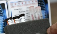nguyên nhân một số trường hợp ở hàn quốc tái dương tính với sars-cov-2 hình 2