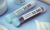 triển khai 10 trạm test nhanh tại các phường gần bv bạch mai hình 2