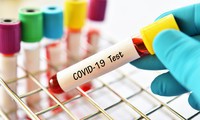 ba lan xác nhận ca nhiễm virus sars-cov-2 đầu tiên hình 2