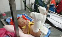 vợ chồng con trai đánh đập mẹ già gần 90 tuổi: cần xử lý nghiêm hình 3