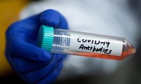 sars-cov-2 có thể đã lây sang người từ đầu tháng 10/2019 hình 2