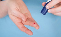 xét nghiệm tìm kháng thể sars-cov-2 trong 15 phút hình 2