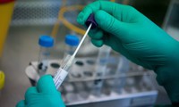 cập nhật: cuộc chiến chống cúm do virus corona hình 1