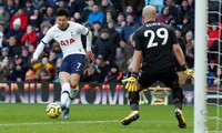 son heung-min dính chấn thương nặng phải lên bàn mổ hình 2