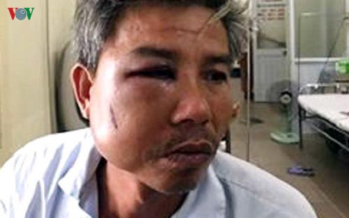 nong 24h: khach la rut bua dap lien tiep vao dau nu chu quan ca phe hinh 4