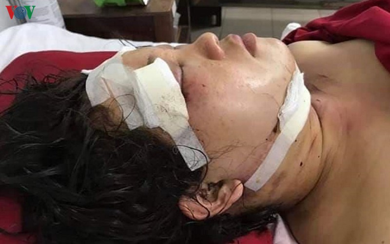 mau thuan, chong danh vo nguy kich roi treo co tu tu  ​ hinh 2