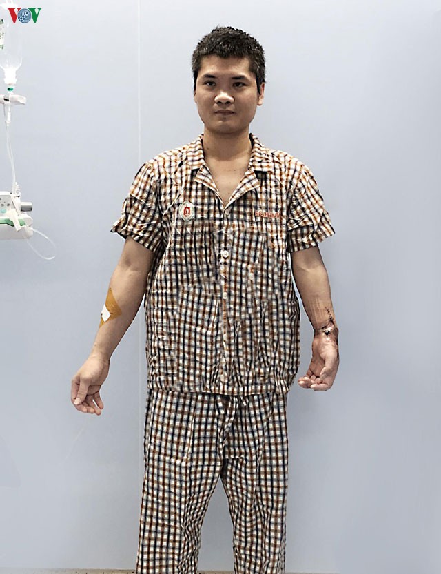 viet nam thuc hien ca ghep chi the dau tien tren the gioi tu nguoi cho song hinh 3
