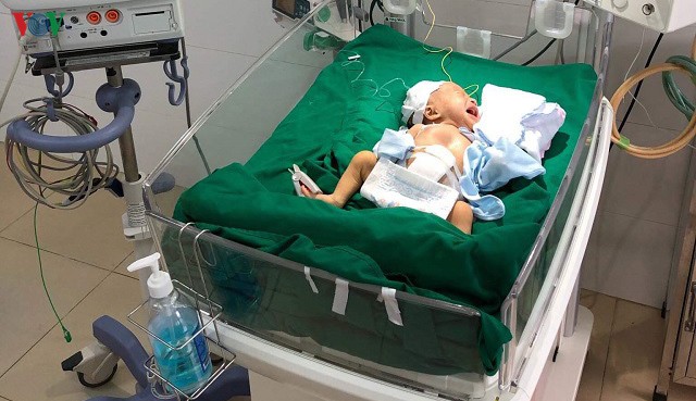 cuu song em be bi di tat bam sinh khien toan bo noi tang loi ra ngoai hinh 2