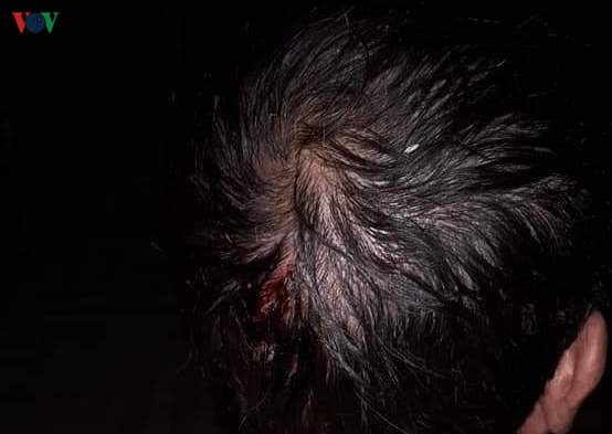 nhieu xa bien gioi huyen phong tho, lai chau tan hoang vi mua da, gio loc hinh 12