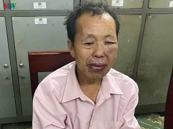 bi vay bat "ong trum" ma tuy chong tra quyet liet lam 1 trinh sat bi thuong hinh 1