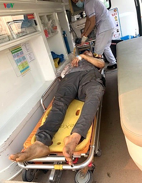 nam thanh nien o da nang bi tau hoa can lia tay hinh 1