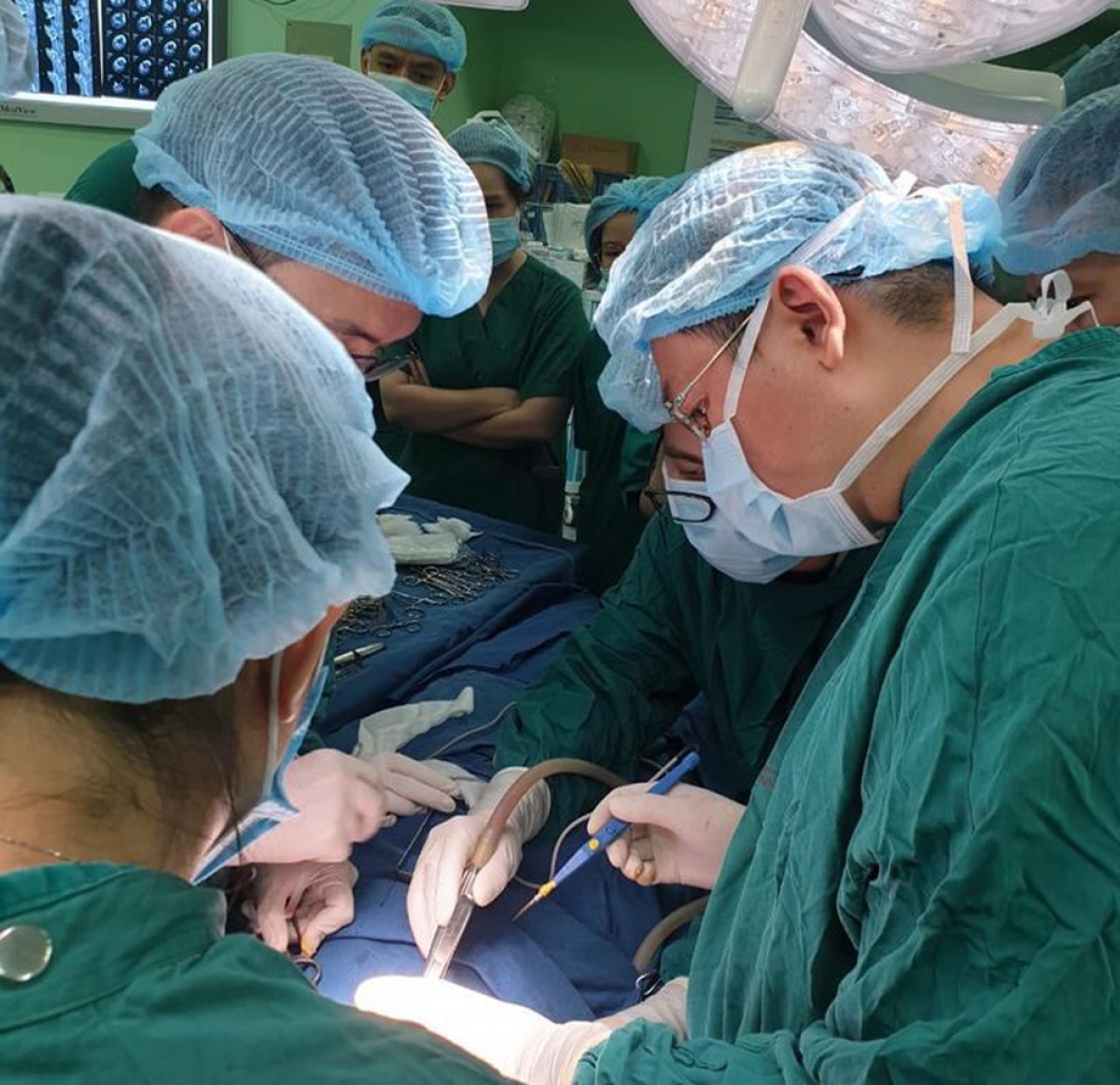 Ê kíp phẫu thuật của Bệnh viện Nhi Trung ương cứu sống bé trai 7 tuổi bị kéo đâm xuyên cổ. (Ảnh: BVCC)