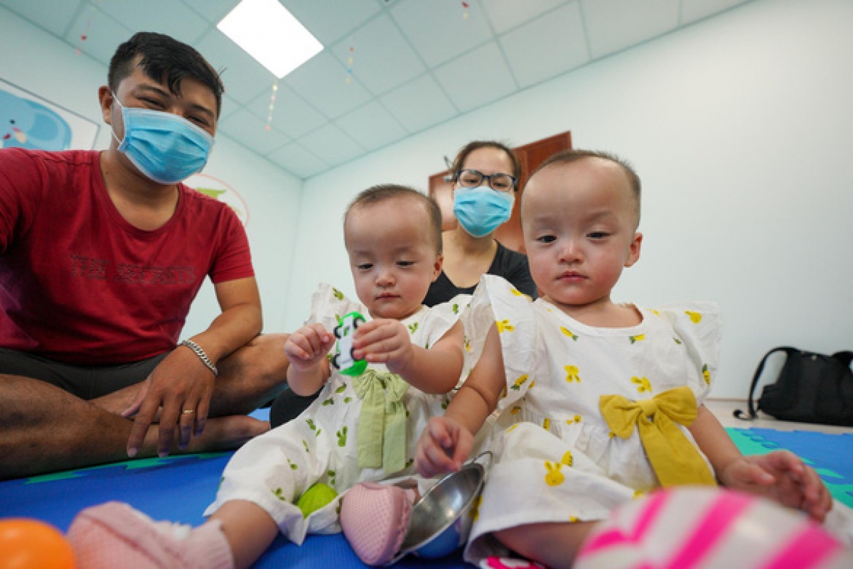 Ngày 30-9, Trúc Nhi - Diệu Nhi sẽ được về nhà đón Tết Trung thu trong thời gian chờ ca phẫu thuật tiếp theo - Ảnh: Bệnh viện cung cấp