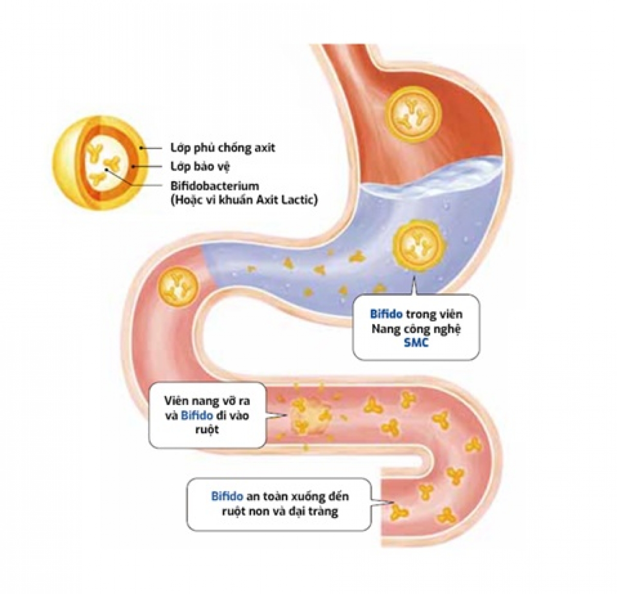 Công nghệ SMC đưa lợi khuẩn sống Bifido vào sâu tận đại tràng.