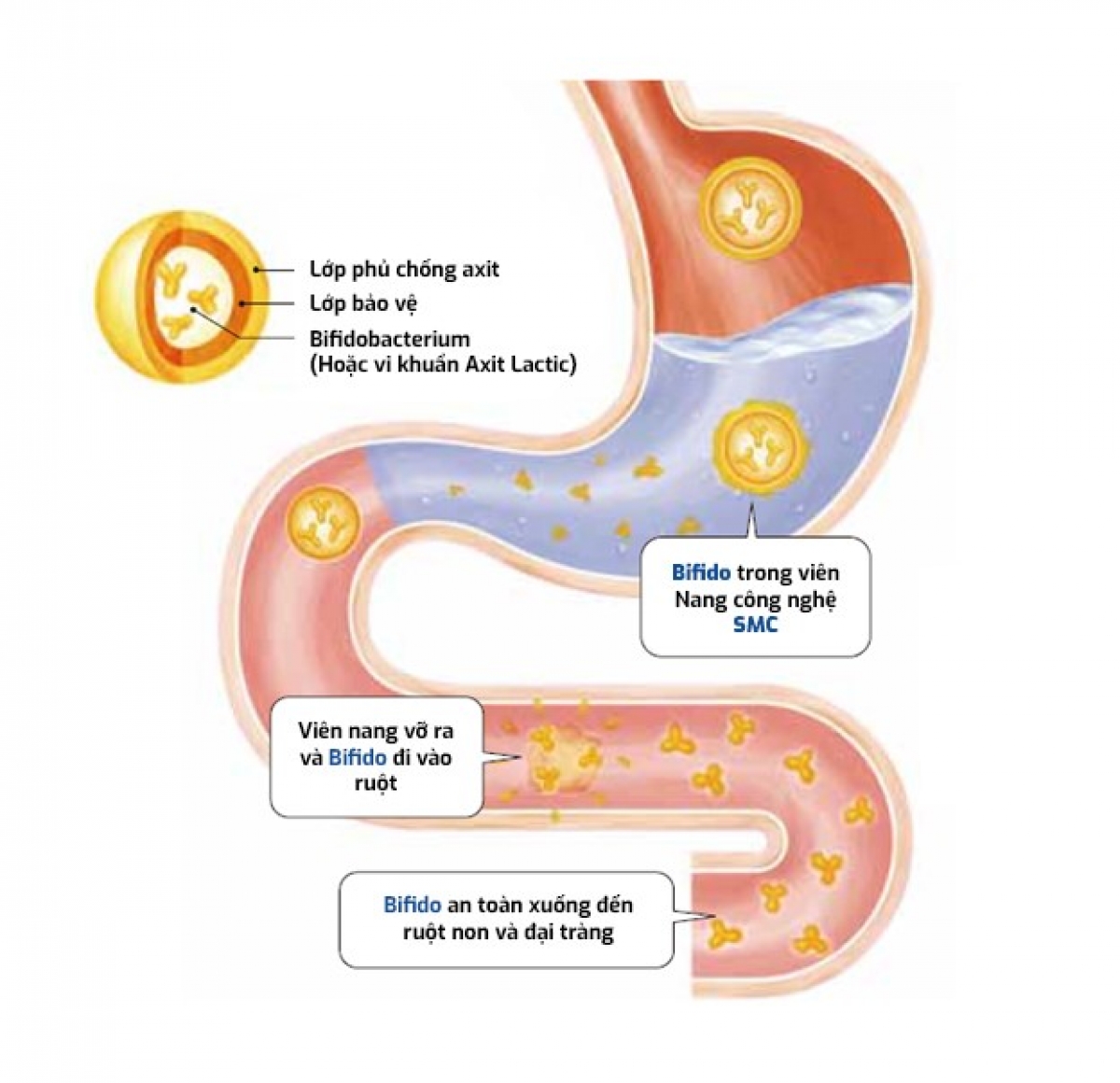 Công nghệ SMC đưa lợi khuẩn sống Bifido vào sâu tận đại tràng.