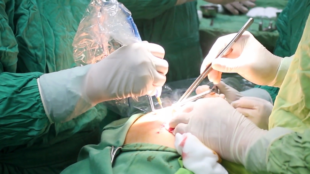 Các Y bác sĩ tiến hành phẫu thuật lấy khối u ra ngoài.