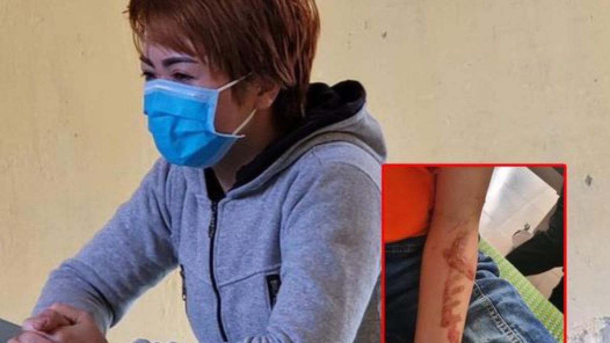 Chủ quán Nguyễn Thị Ánh Tuyết và hình cháu bé bị bạo hành.
