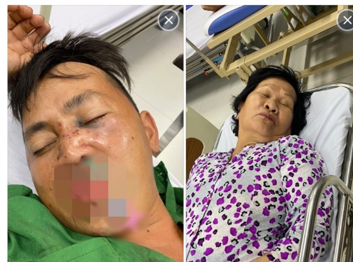 Sau khi bị đánh "hội đồng" , bà Nguyễn Thị Tầm và con trai bị trọng thương phải nhập viện điều trị