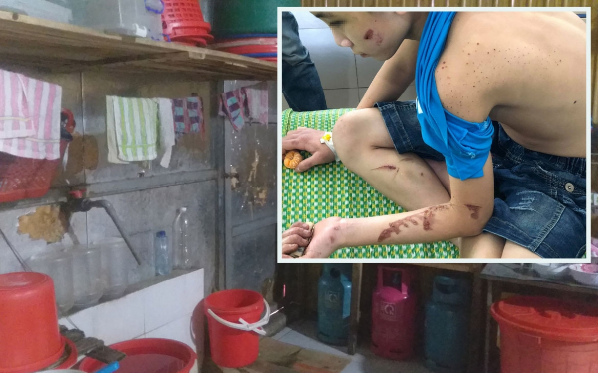 Nạn nhân trong vụ ngược đãi, tra tấn trẻ em ở quán bánh xèo tỉnh Bắc Ninh.