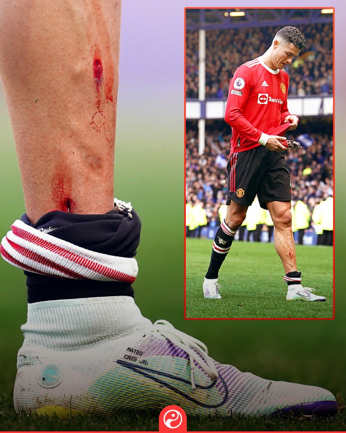 Cristiano Ronaldo chịu 2 vết rách trên chân trái, nhưng chỉ có 1 cú sút trước Everton. (Ảnh: Squawka)