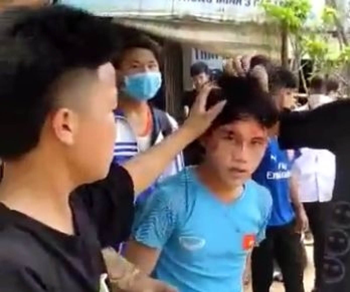 Khiến 1 học sinh bị chảy máu đầu.