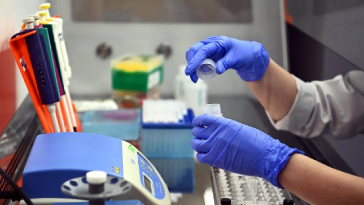 Kit thử mới được đánh giá là có hiệu quả cao trong việc phát hiện virus, hạn chế khả năng cho kết quả âm tính giả. Ảnh minh họa: Sputniknews