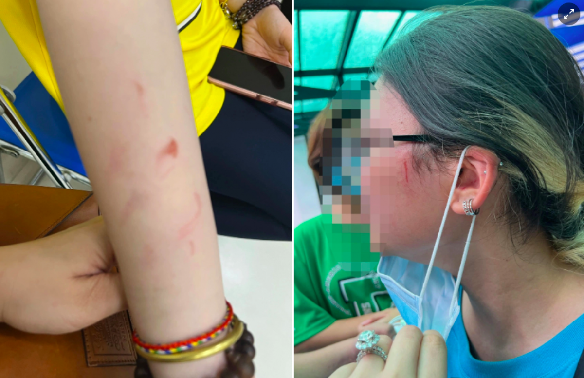 Hình ảnh học sinh bị thương trong vụ xô xát tại trường quốc tế TP.HCM.