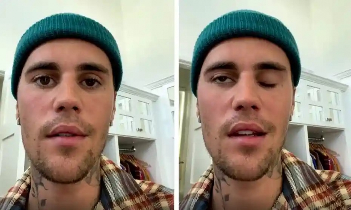 justin bieber bị tê liệt nửa mặt vì mắc căn bệnh lạ hình ảnh 1 justin bieber bi te liet nua mat vi mac can benh la hinh anh 1