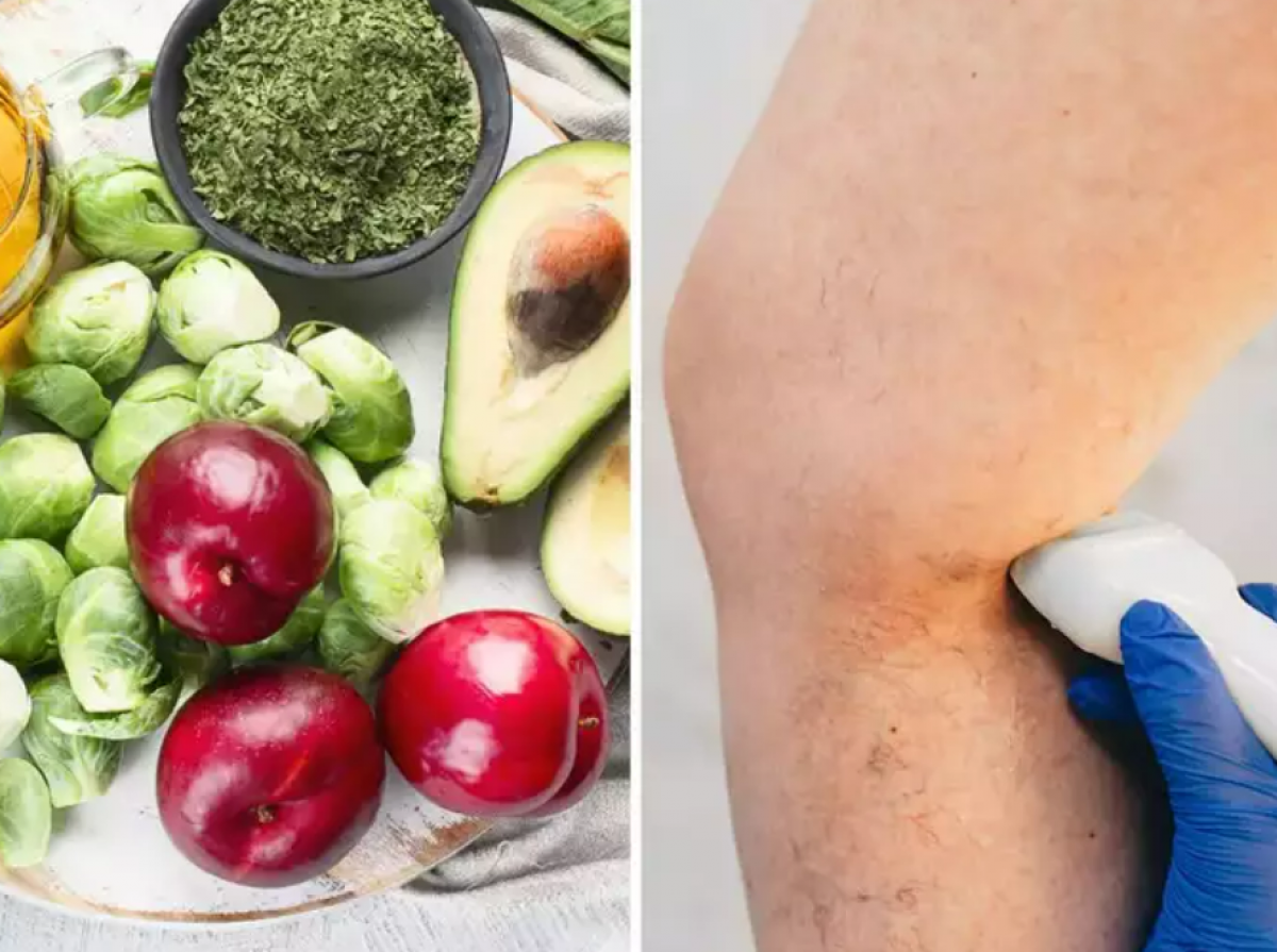 thiếu hụt 2 loại vitamin này có thể ảnh hưởng đến quá trình đông máu hình ảnh 1 thieu hut 2 loai vitamin nay co the anh huong den qua trinh dong mau hinh anh 1