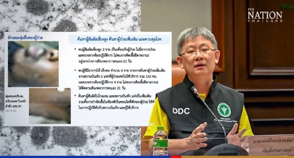 thái lan mất dấu ca bệnh đậu mùa khỉ đầu tiên trong cộng đồng hình ảnh 1 thai lan mat dau ca benh dau mua khi dau tien trong cong dong hinh anh 1