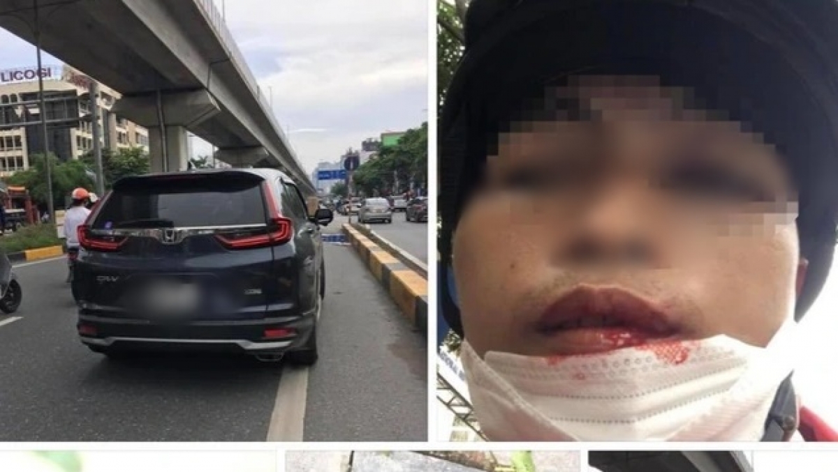tài xế xe ôm bị lái xe cr-v đấm gãy răng vì...không cho vượt hình ảnh 1 tai xe xe om bi lai xe cr-v dam gay rang vi...khong cho vuot hinh anh 1