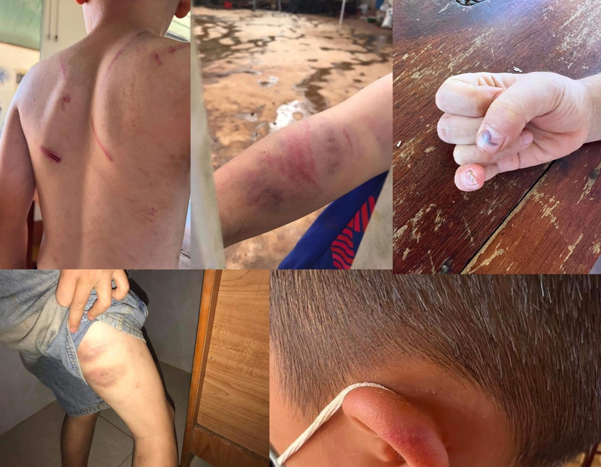 công an vào cuộc vụ cháu bé 9 tuổi bị bố và bà nội đánh đập hình ảnh 1 cong an vao cuoc vu chau be 9 tuoi bi bo va ba noi danh dap hinh anh 1