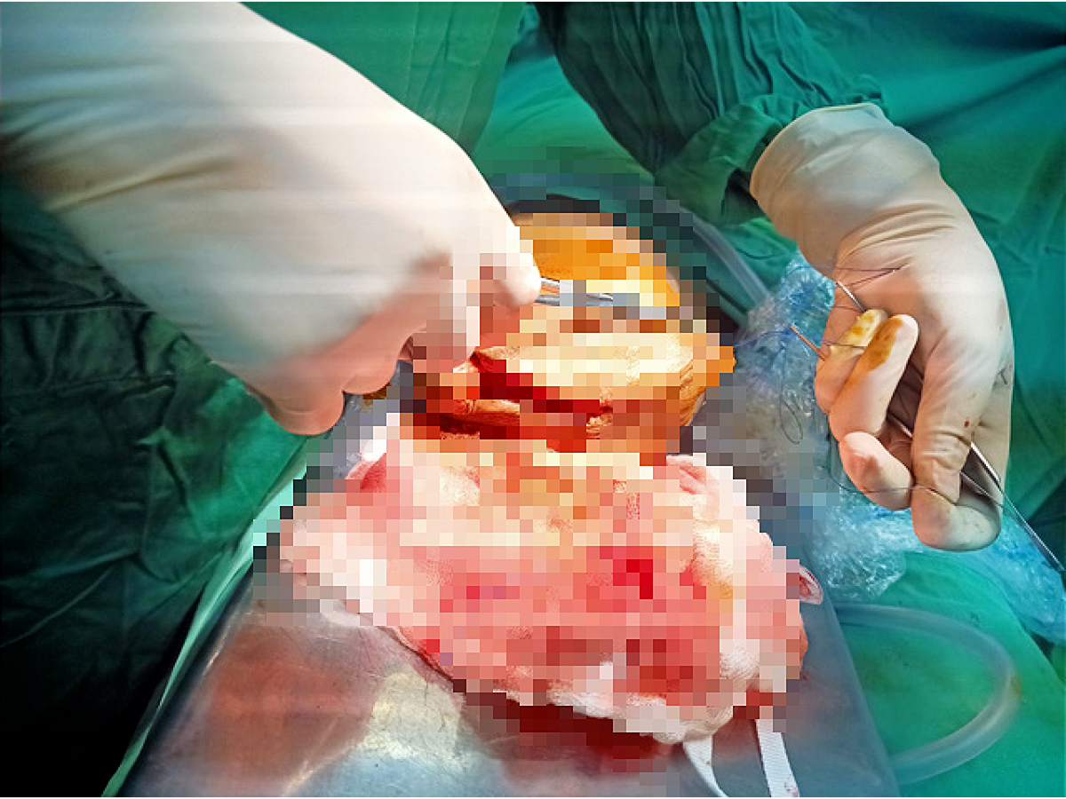 một phạm nhân ở Đắk lắk tự cắt lìa dương vật của mình hình ảnh 1 mot pham nhan o Dak lak tu cat lia duong vat cua minh hinh anh 1