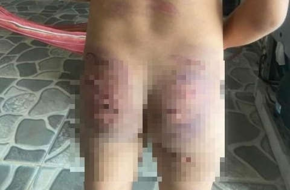 be gai 7 tuoi o binh phuoc bi cha duong bao hanh sap xuat vien hinh anh 1