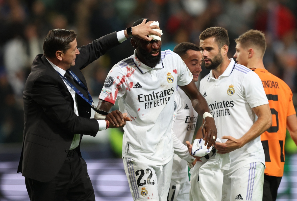 real madrid thoát thua ngoạn mục trước shakhtar donetsk hình ảnh 1 real madrid thoat thua ngoan muc truoc shakhtar donetsk hinh anh 1